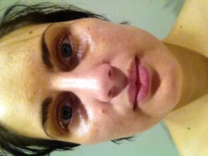 Amanda Bailey skin treatment north melbourne
